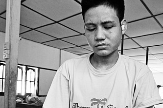 Naing Htoo mit Narben im Gesicht.