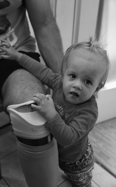 Mirsads Kind hält sich an seiner Prothese fest.